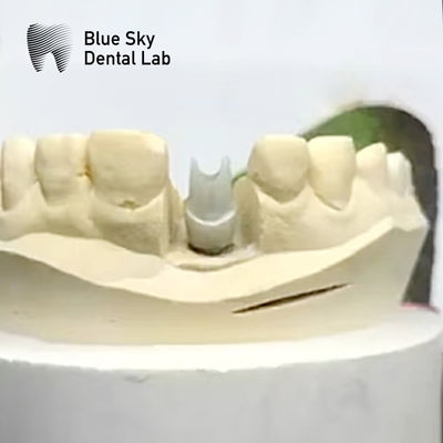 खरीदें सौंदर्य Zirconia Abutment प्रत्यारोपण जैव संगत परिशुद्धता मिल online manufacture