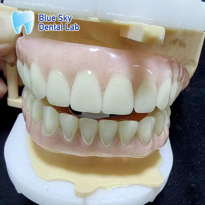 ब्लूस्की अस्थायी ऐक्रेलिक आंशिक प्रोटेक्ट पूर्ण ऊपरी और निचले ऐक्रेलिक प्रोटेक्ट